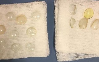 隐形眼镜怎么拿下，隐形眼镜怎么拿下来最简单