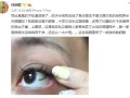 隐形眼镜放破了怎么办，隐形眼镜放破了怎么办小妙招